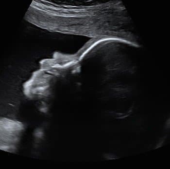 scan img-11.jpeg