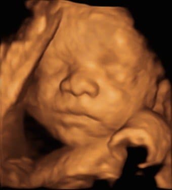 scan img-2.jpeg