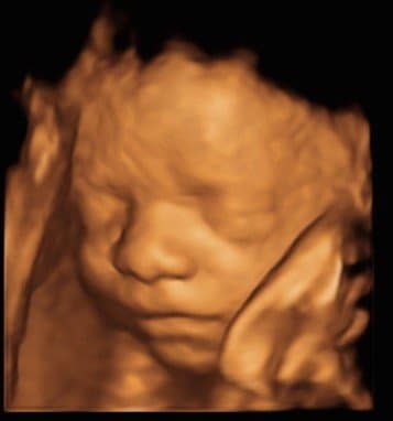 scan img-4.jpeg