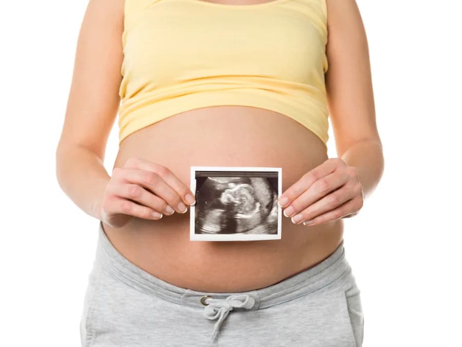 Mum-to-be holding her early pregnancy scan print in front of her bump