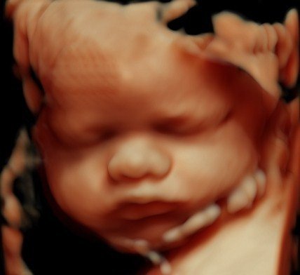 Baby scan image 6