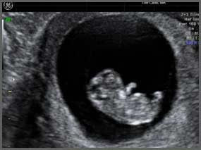 Baby scan image 12